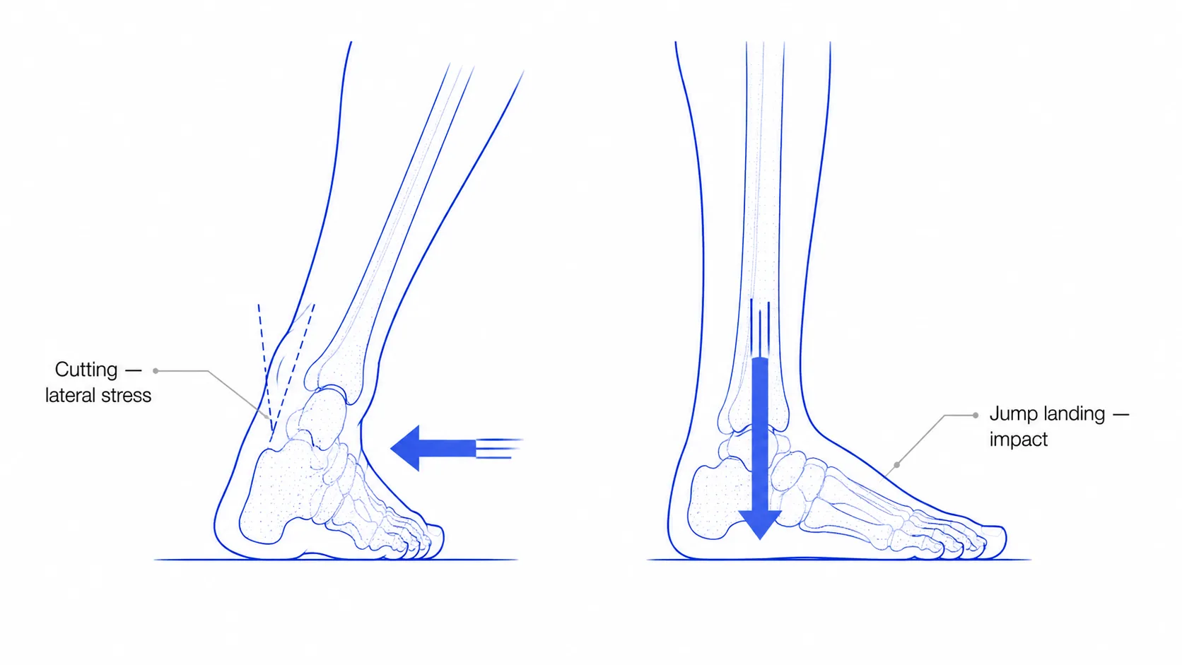 Diagram of basketball foot loads — a foot cutting sideways with lateral force, and a foot landing from a jump with vertical impact