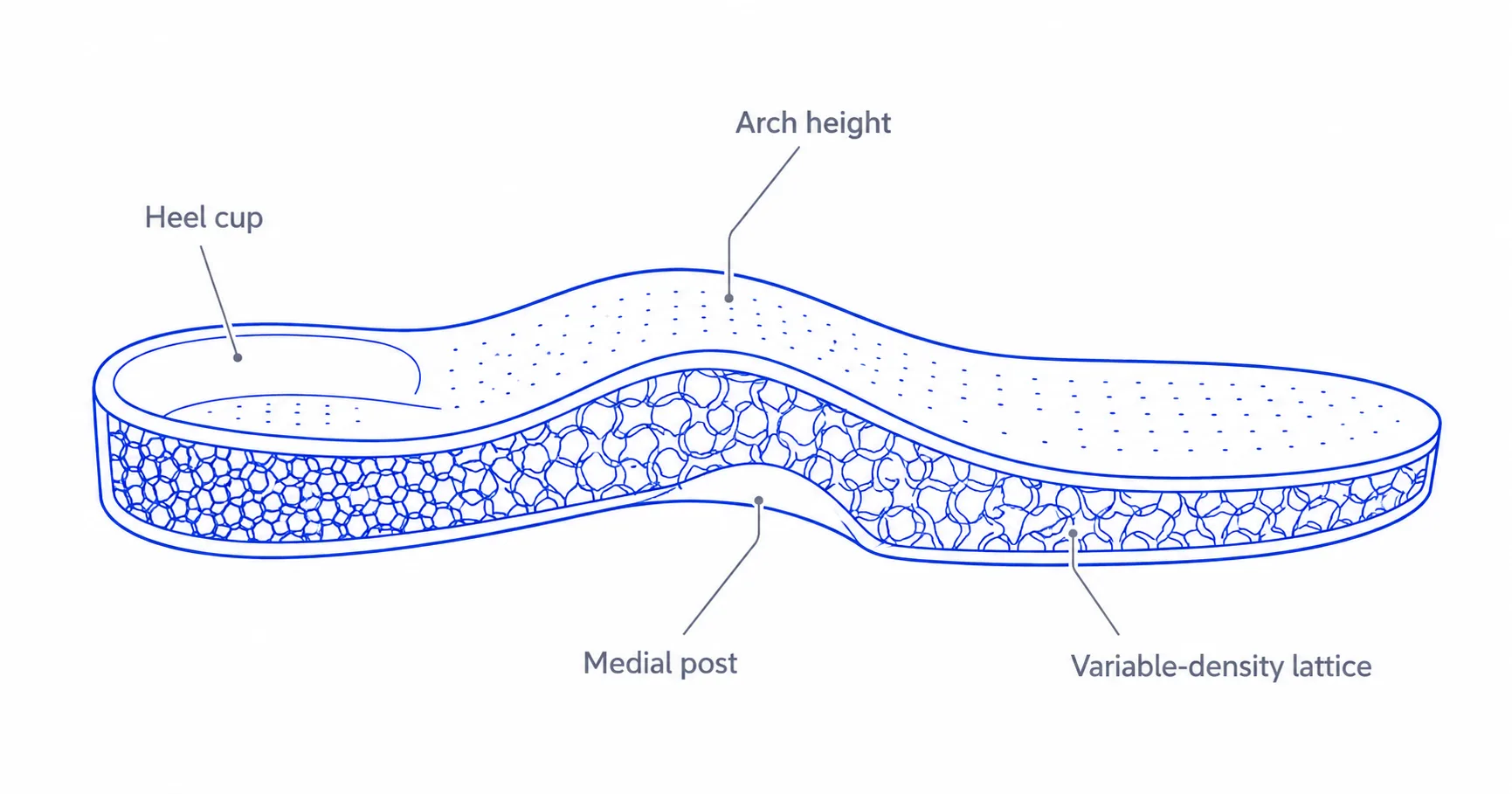 Custom arch support insoles — adjustable arch height, heel cup and posting parameters