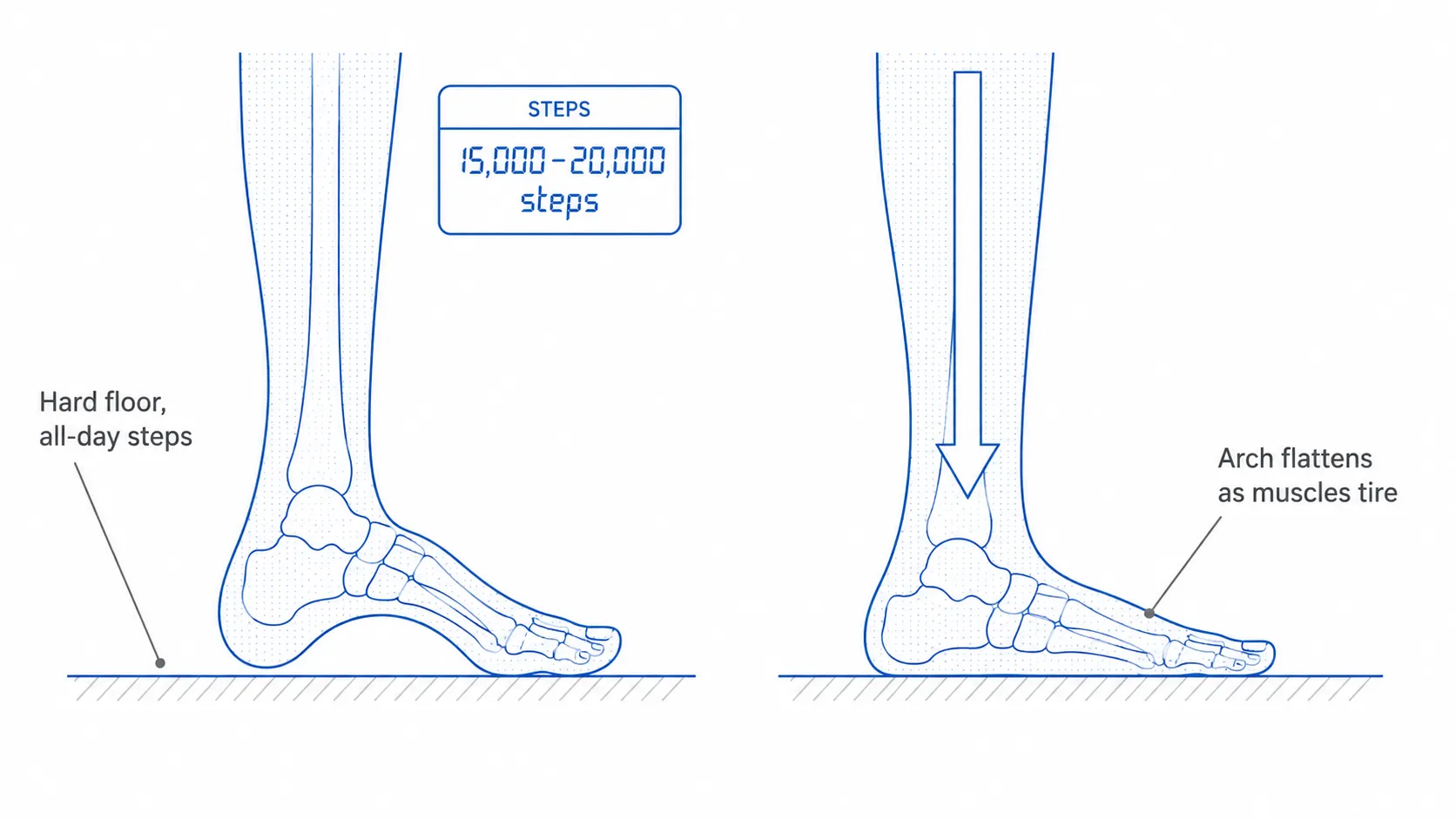 Diagram of an all-day standing load — a foot on a hard floor with a step counter and an arch flattening as muscles tire over a long shift
