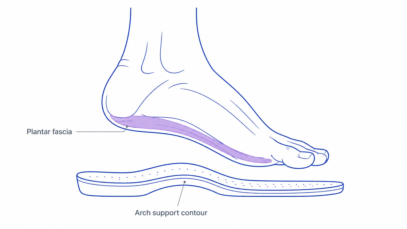 Custom insoles for plantar fasciitis — firm arch support and deep heel cup for heel pain relief