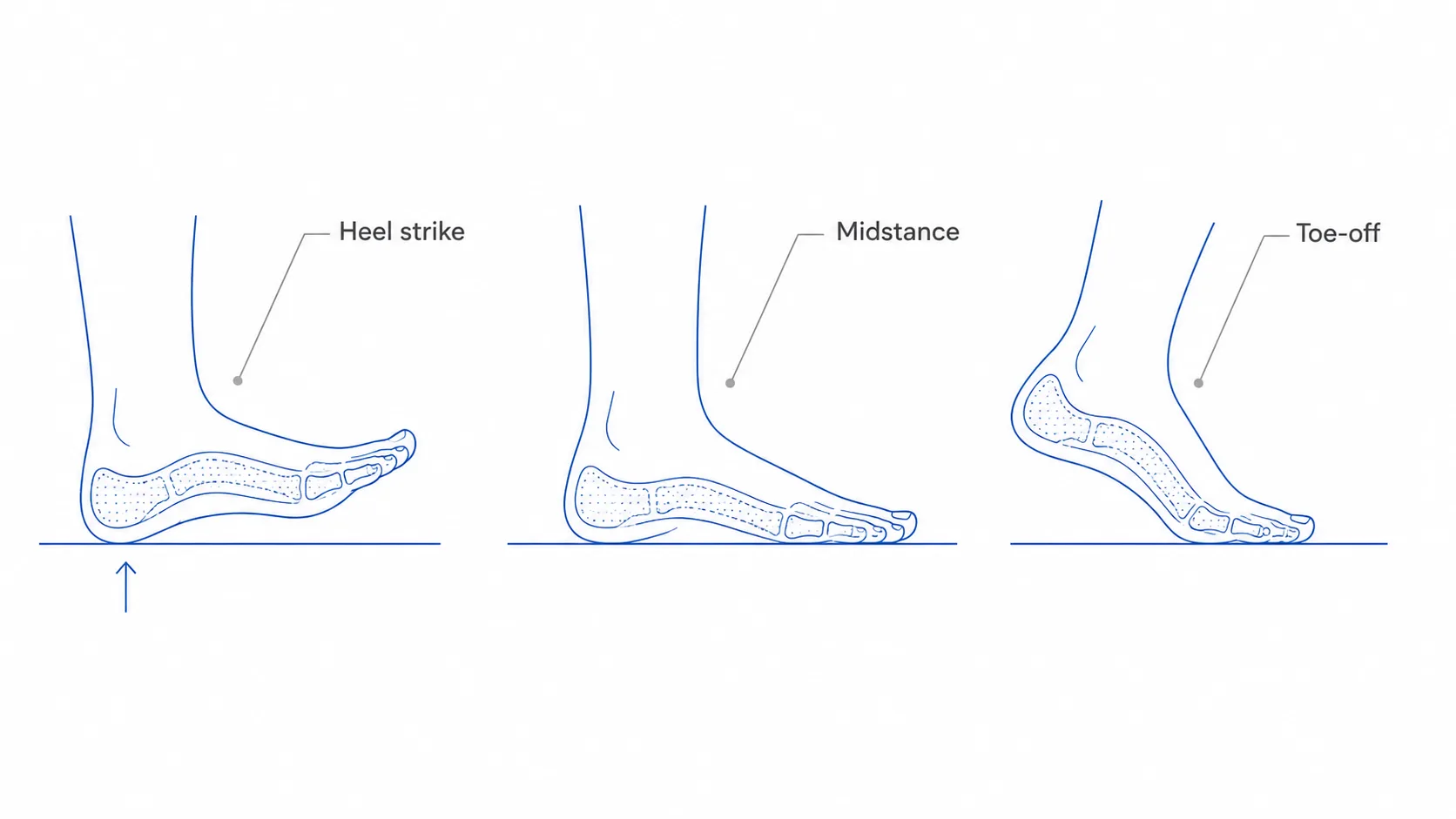 Diagram of the running gait cycle from heel strike through midfoot to toe-off with impact forces marked