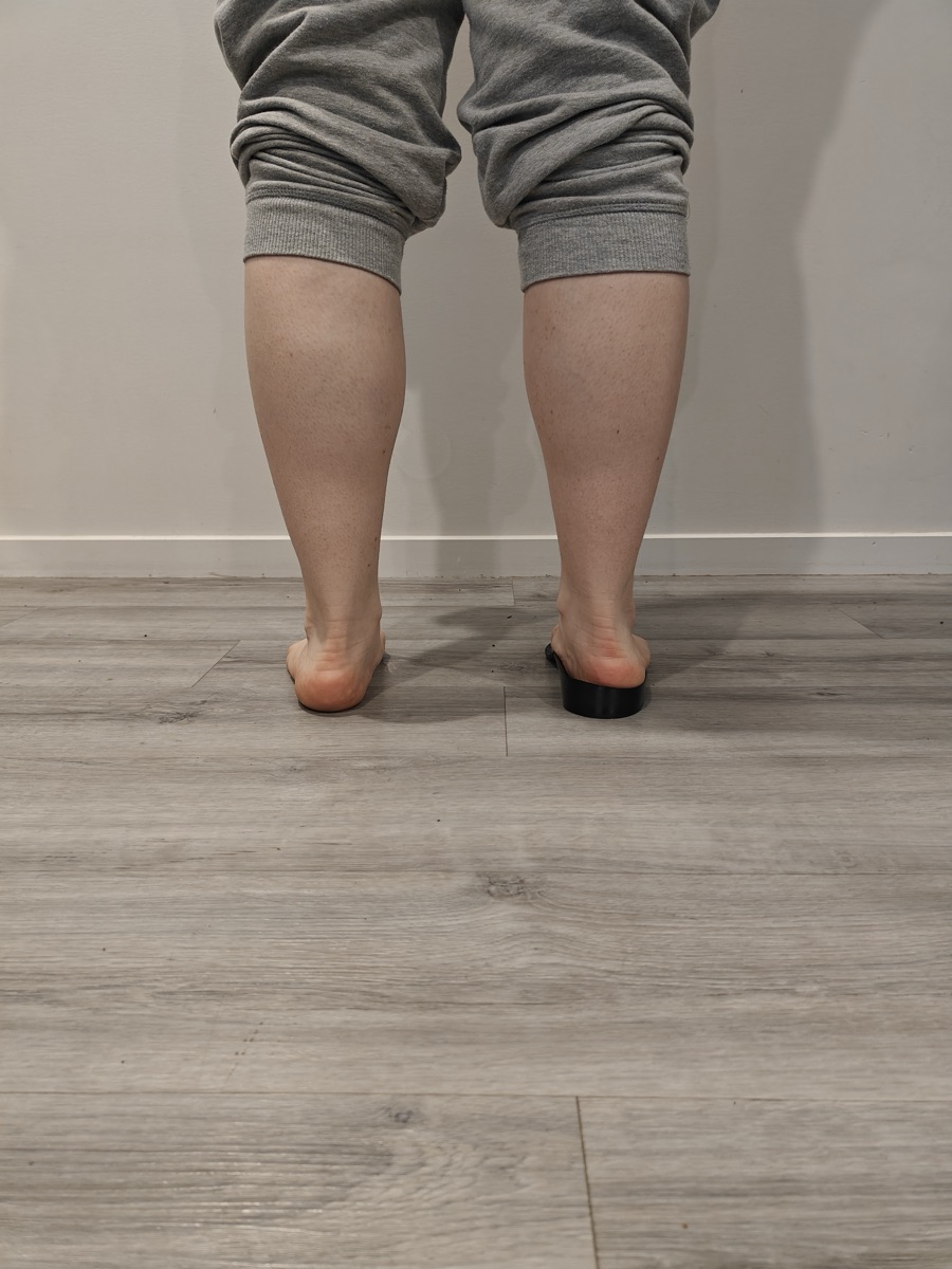 Eine Person steht mit einem Fuß auf einer 3D-gedruckten Einlage und dem anderen flach, zeigt die Gewölbeanhebung